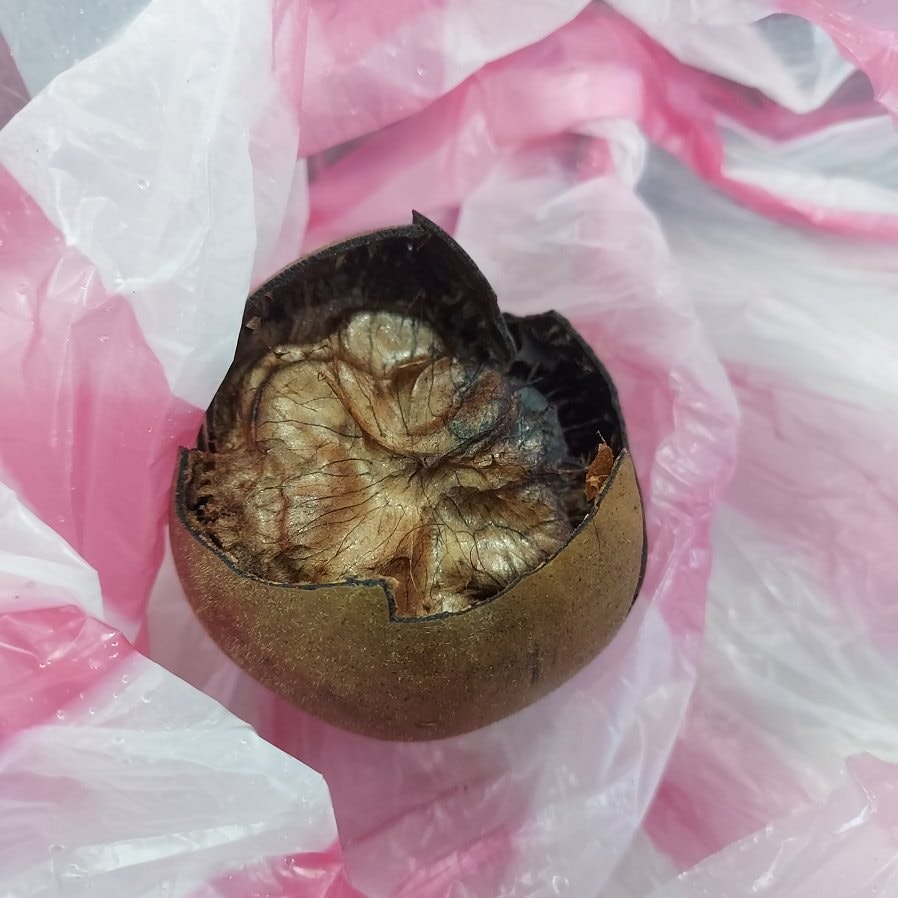 聲帶長繭┃從聲帶瘜肉變長繭 醫院嗓音治療 西藥中藥 澎大海等都試 吞嚥卡卡 無法久說快話長說 歷程分享